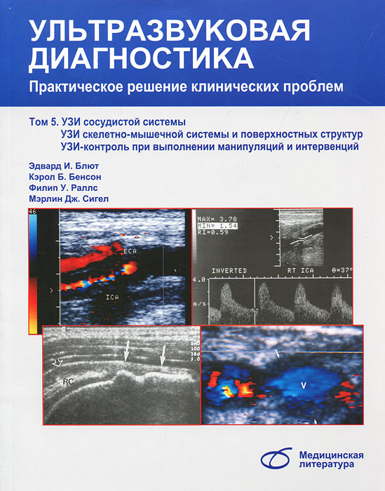 Ультразвуковая диагностика. практическое решение клинических проблем. Том 5 | Раллс Филип У., Блют Эдвард #1