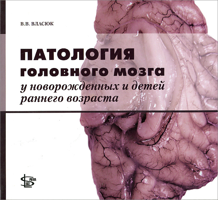 Патология головного мозга у новорожденных и детей раннего возраста | Власюк Василий Васильевич  #1