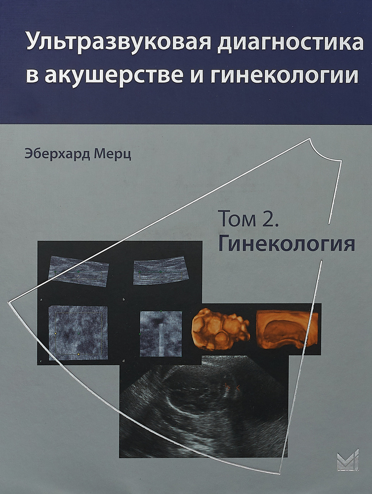 Ультразвуковая диагностика в акушерстве и гинекологии. Том 2. Гинекология | Мерц Эберхард  #1