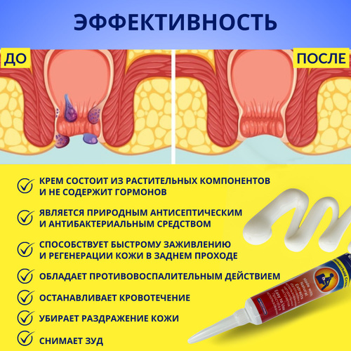 Зуд в заднем проходе - симптомы, причины и лечение