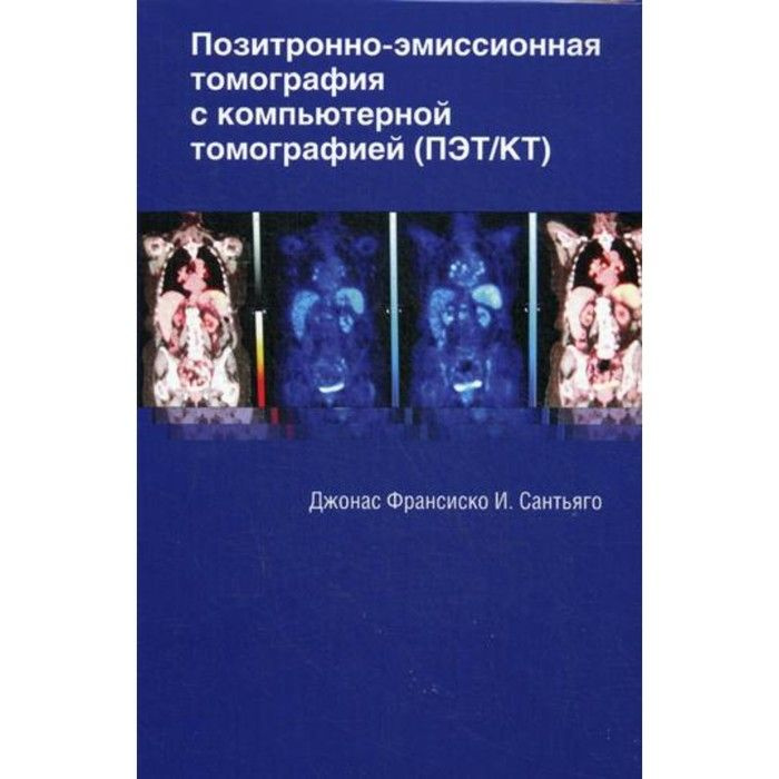 Позитронно-эмиссионная томография с компьютерной томографией (ПЭТ/КТ) | Сантьяго Джонас Франсиско И. #1