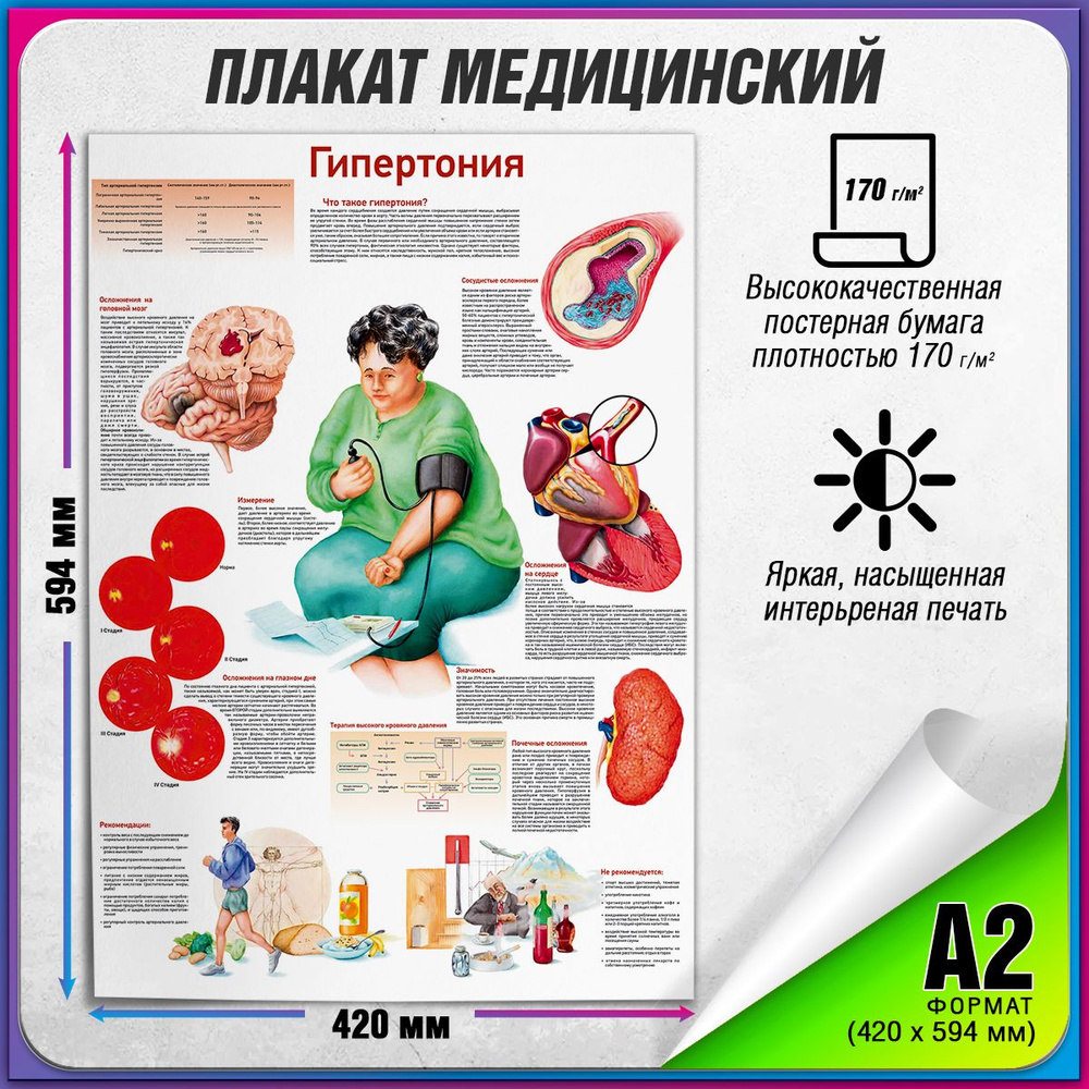 Информационный медицинский плакат "Гипертония" / А-2 (42x60 см.)  #1