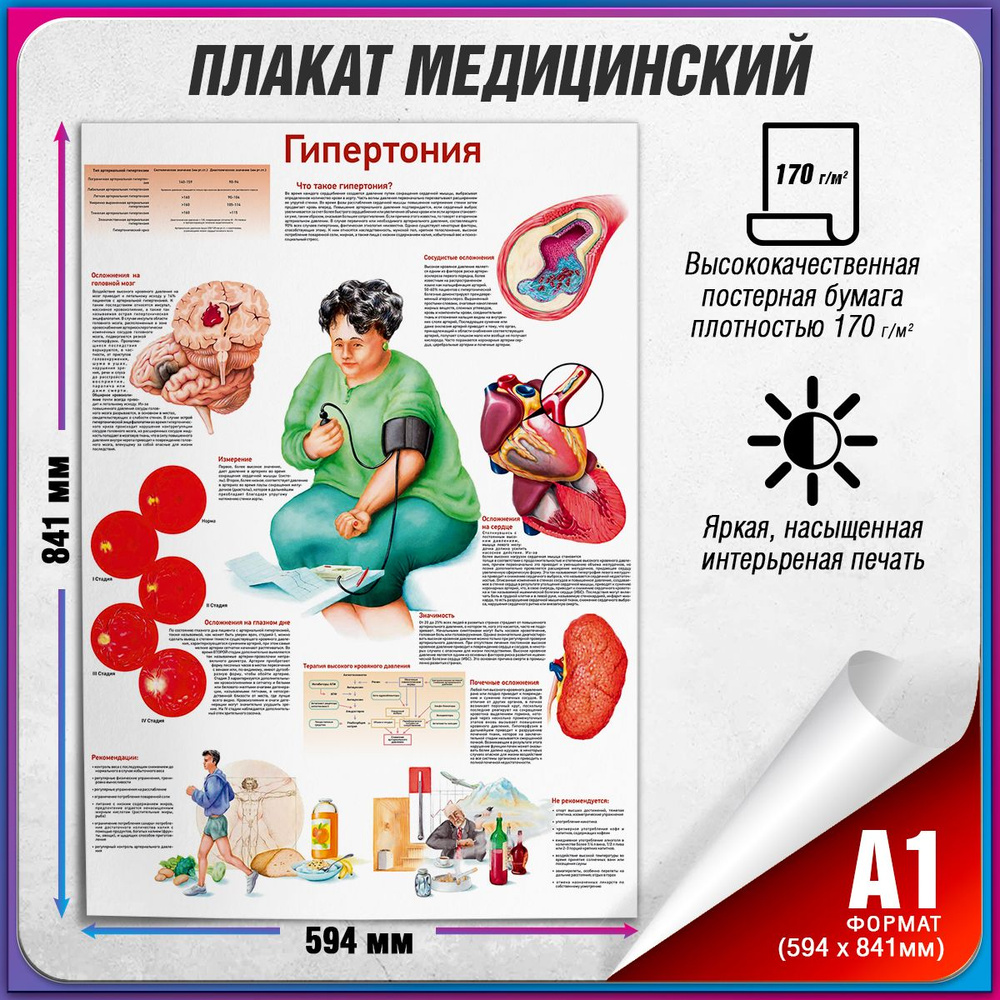 Информационный медицинский плакат "Гипертония" / А-1 (60x84 см.)  #1