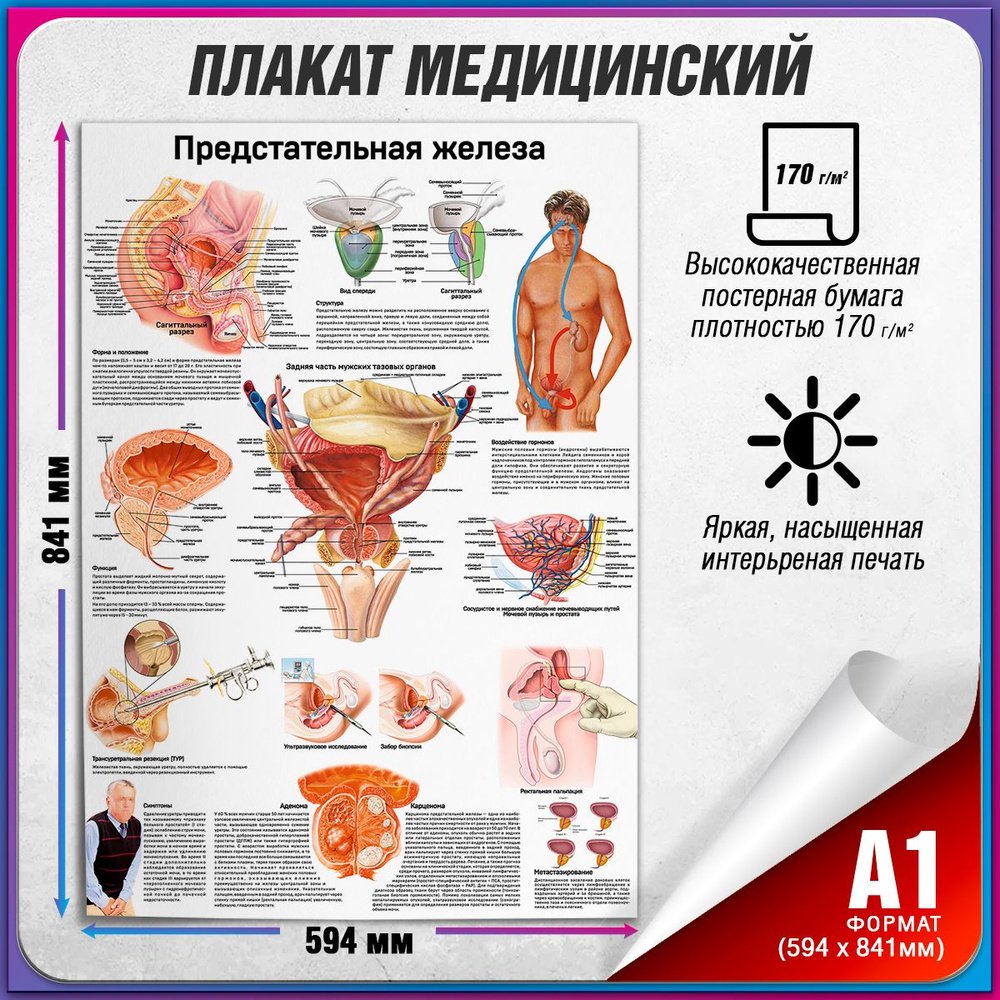 Информационный медицинский плакат "Предстательная железа" / А-1 (60x84 см.)  #1