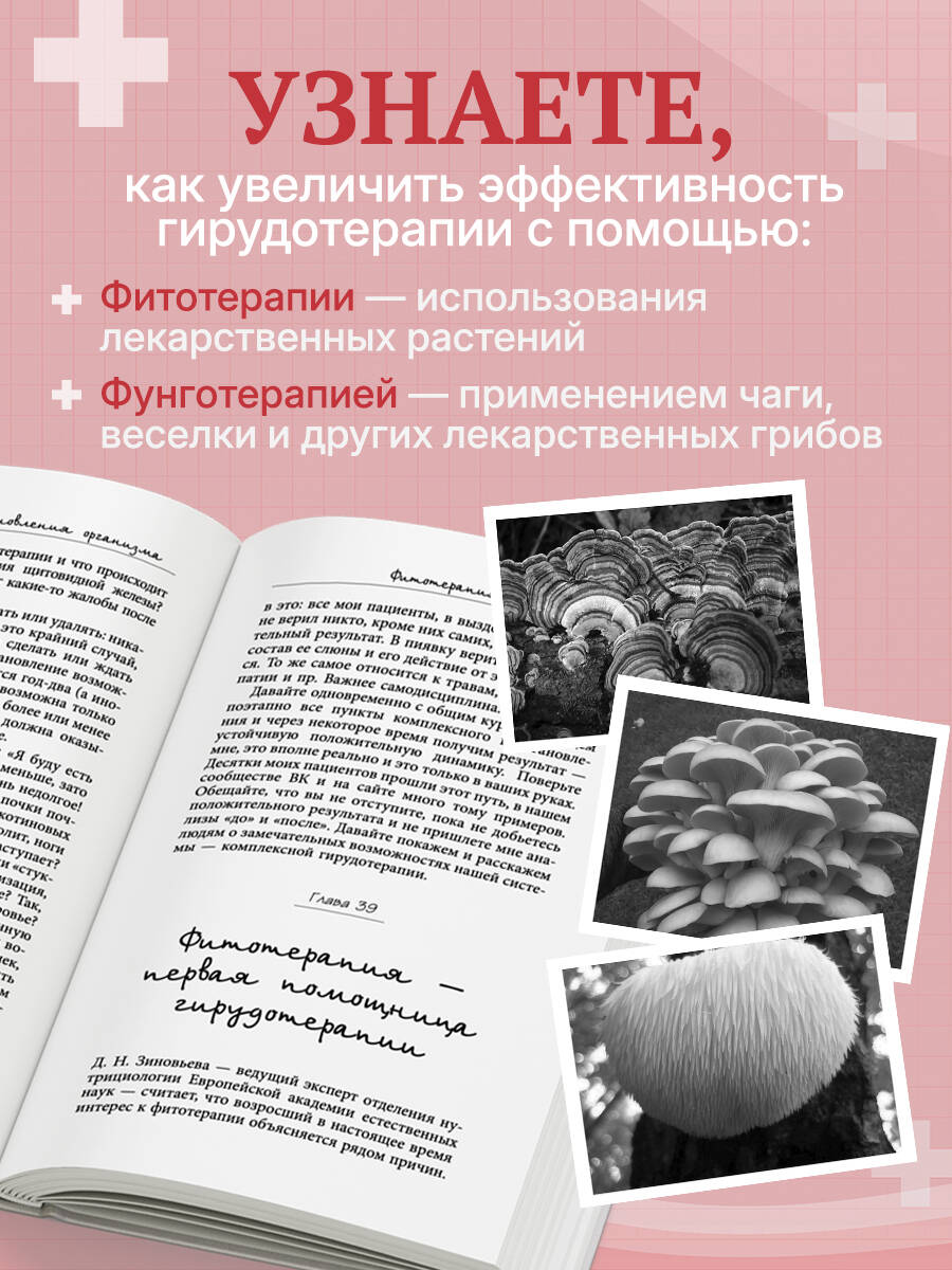 Лечение пиявками. Схемы гирудотерапии при сложных, хронических и запущенных заболеваниях | Leech Treatment: Hirudotherapy Schemes for Complex, Chronic, and Advanced Diseases - Ozon image 3