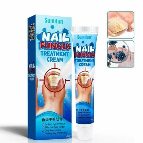 Травяной крем от грибка ногтей Nail Fungus Treatment Cream, 20 г. #1