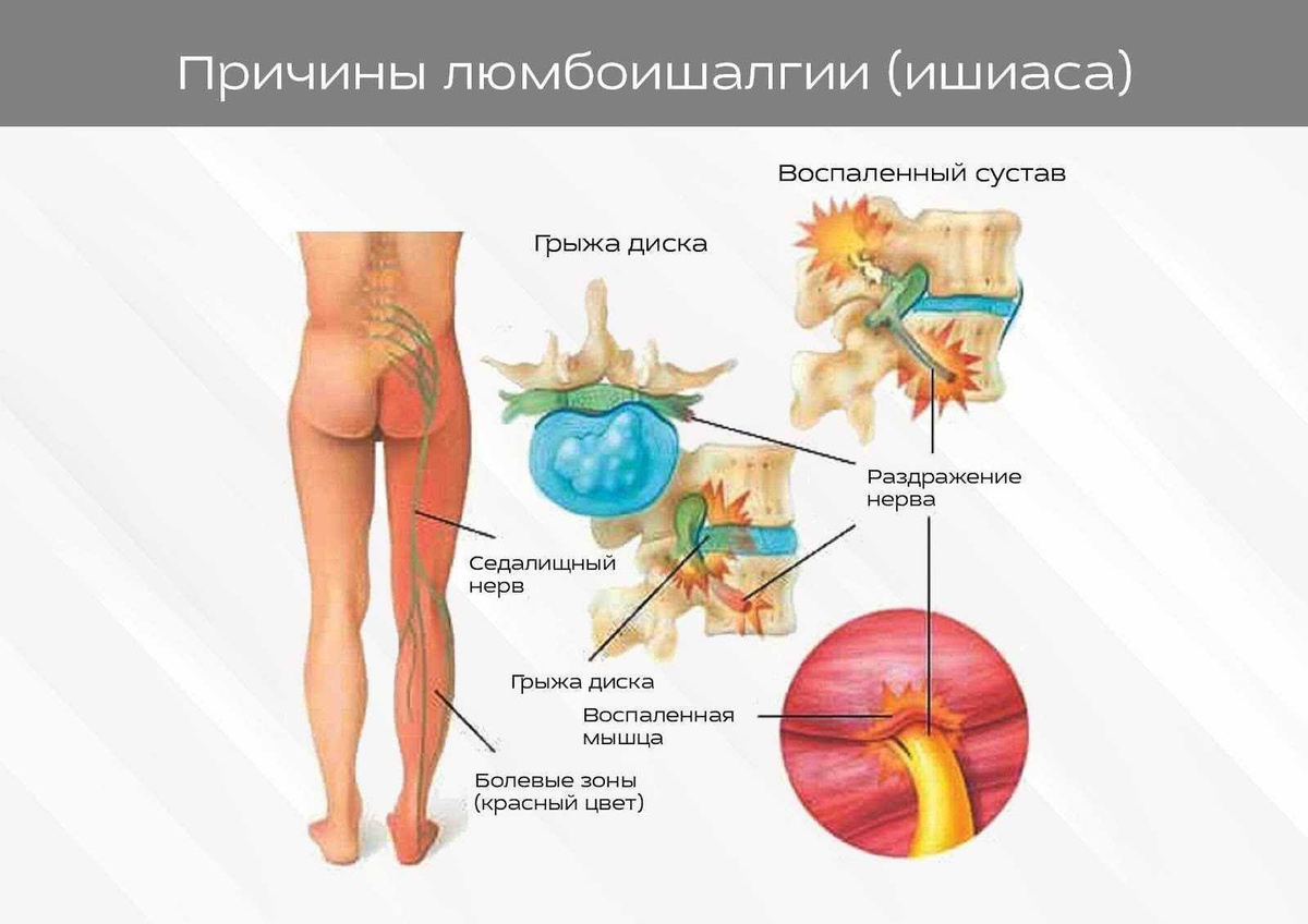 Как правильно использовать бальзам