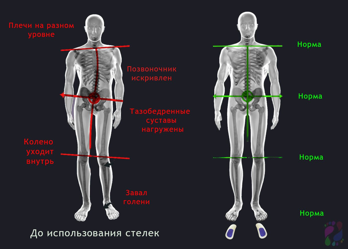 Размеры стелек