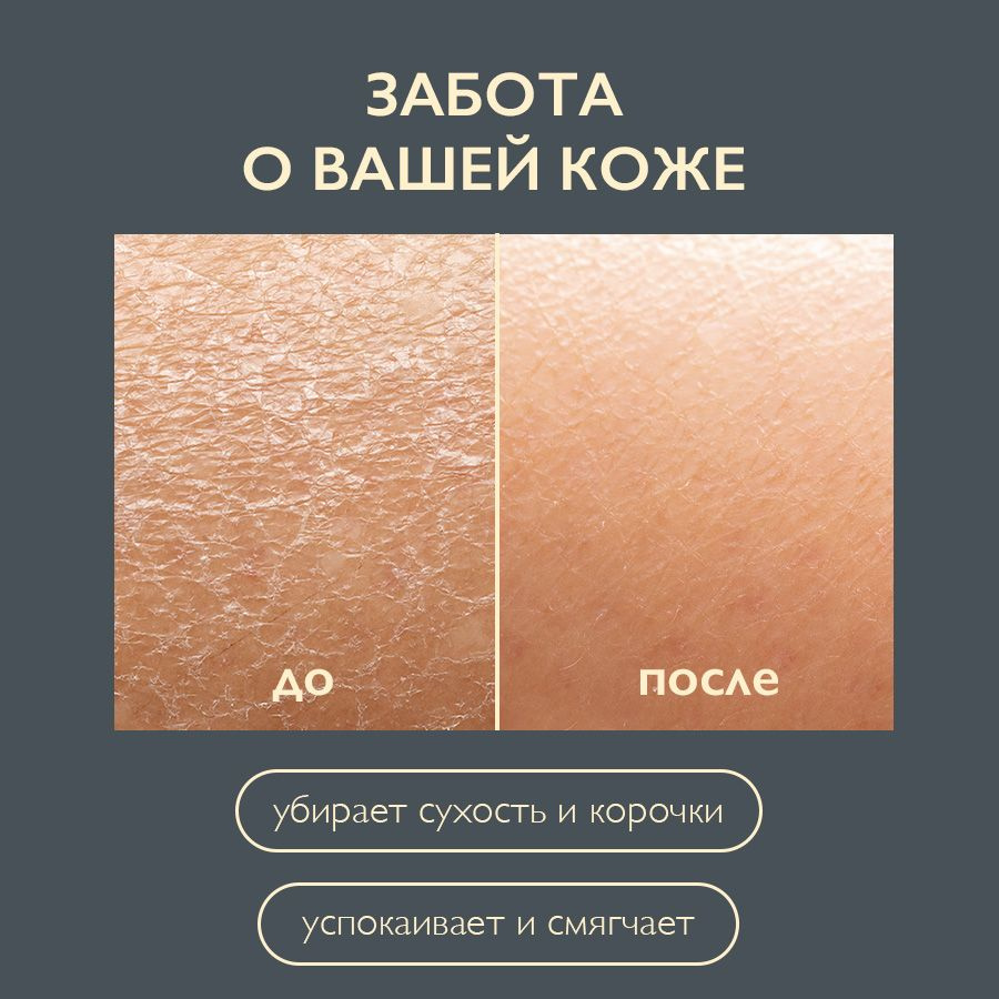 Благодаря экологичной формуле с активным компонентам крем воска AMBREE Professional является незаменимым помощником в вашем арсенале средств по уходу за кожей. Воск создает защитный барьер, предотвращающий появление раздражений. Кератин обеспечивает прочность и эластичность. Витамин Е сохраняет кожу увлажненной, предупреждает появление признаков сухости, способствует обновлению клеток. За счет рисового протеина в кратчайшие сроки происходит восстановление даже самых поврежденных и ослабленных участков кожи.  Бережный и эффективный, крем воск SOS поможет вернуть коже здоровье и красоту, позволяя наслаждаться чувством уверенности и комфорта в любой ситуации, а так же навсегда забыть о сухости и раздражении.