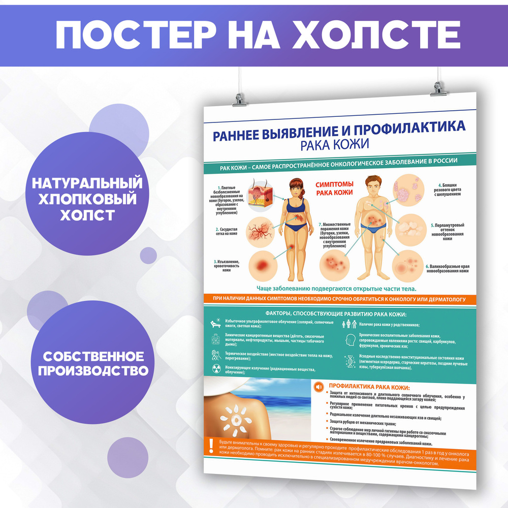 Постер на холсте - Профилактика рака кожи, онкология, медицина 30х40 см  #1