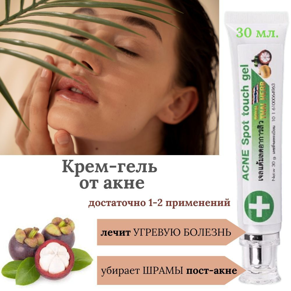 Крем гель от прыщей МИЛИН ACNE Spot touch gel 30 гр. #1