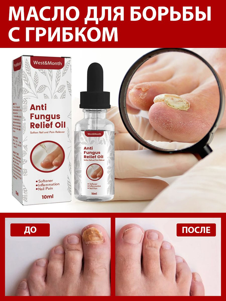Масло ANTI FUNGUS для ногтей от онихолизиса, от грибка, для кутикулы, 100% натурально, 10 мл  #1