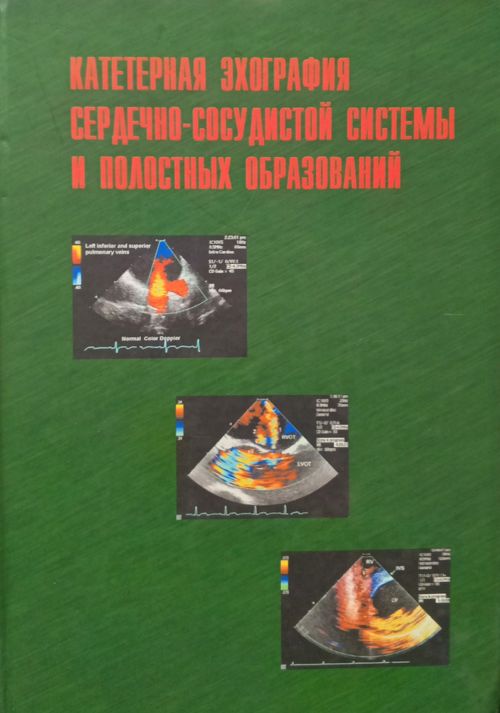 Катетерная эхография сердечно-сосудистой системы и полостных образований - В.А. Сандриков | Сандриков #1