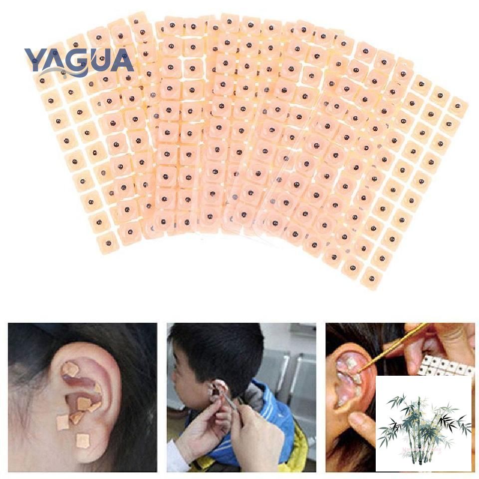 Иглаакупунктурная