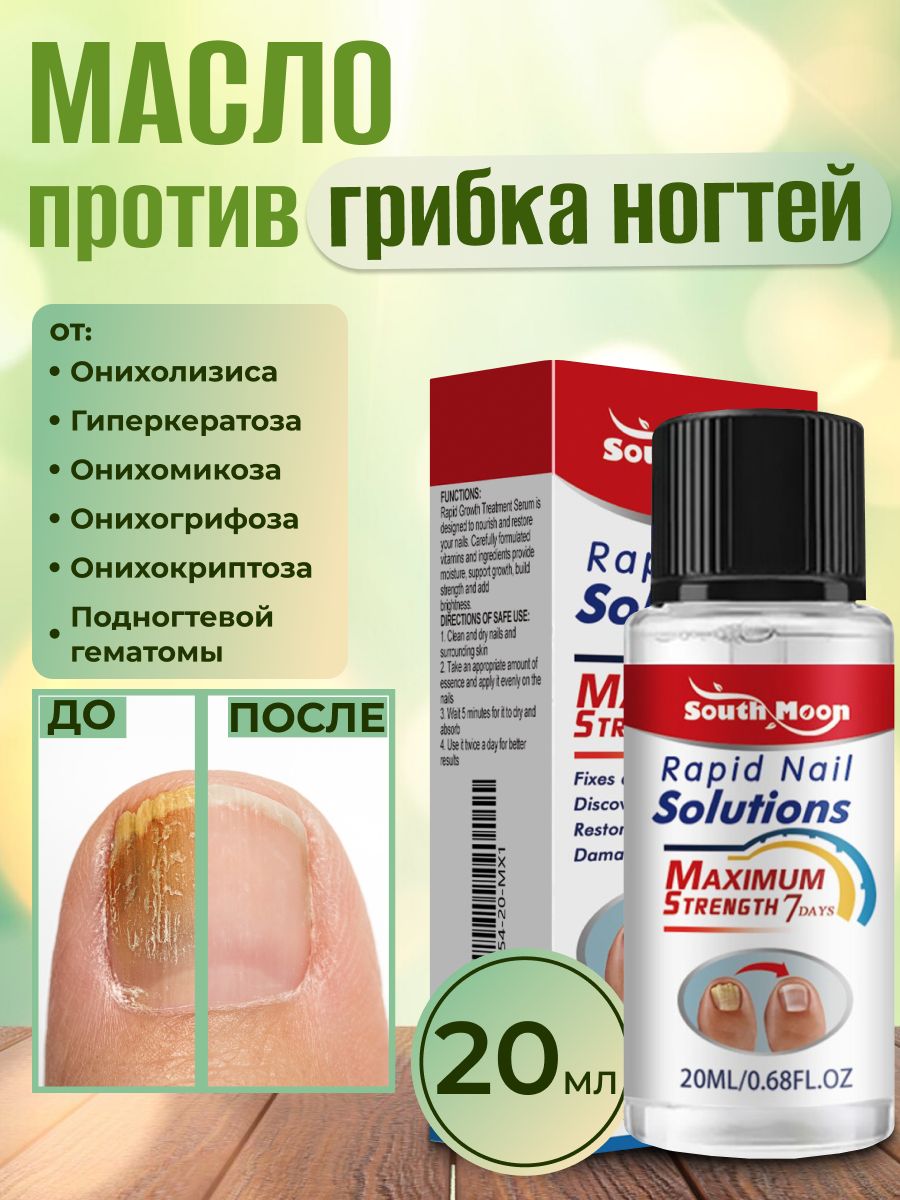 Маслодляногтейотгрибка,средстводлялечениягрибка,"Rapid",20мл.,лечениеонихолизиса
