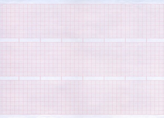Лента тепловая регистрационная для ЭКГ Комус Медицина Fukuda, N.Kohden 145 мм x 30 м внутренняя намотка #1