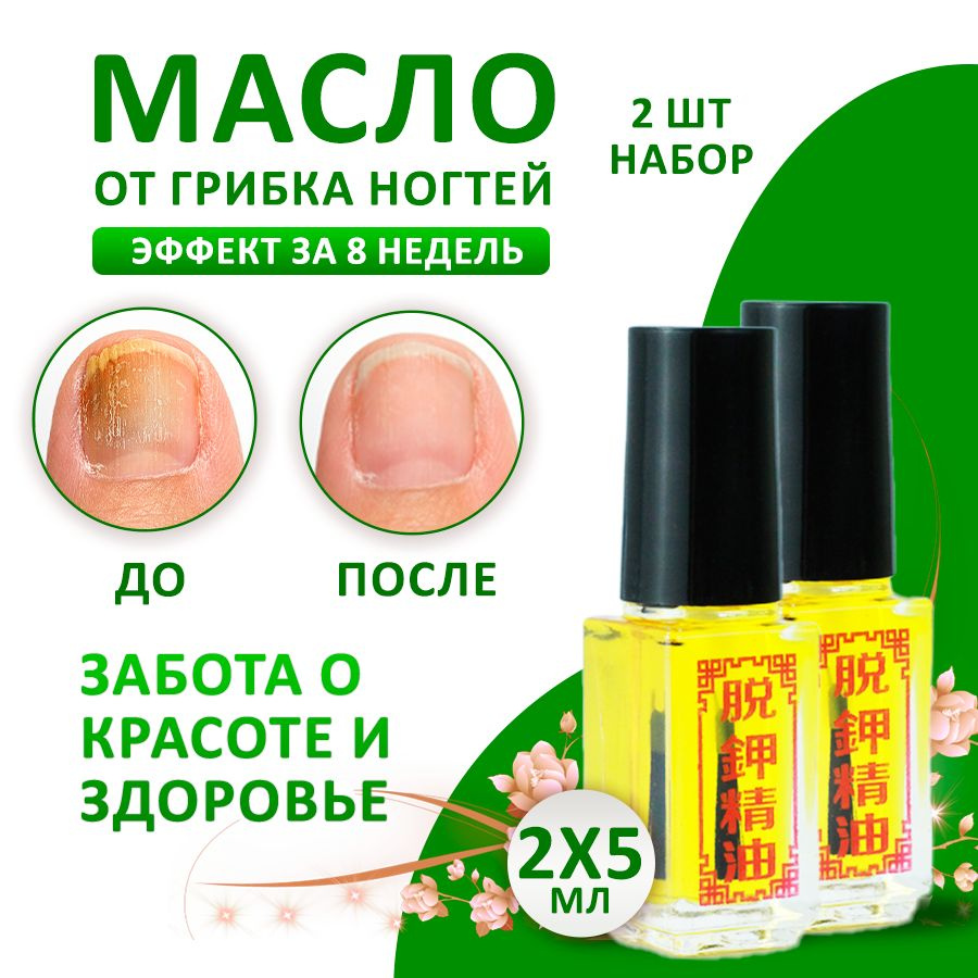 Масло для ногтей средство для лечения грибка и онихолизиса, 2 шт по 5 мл SilaVeres  #1