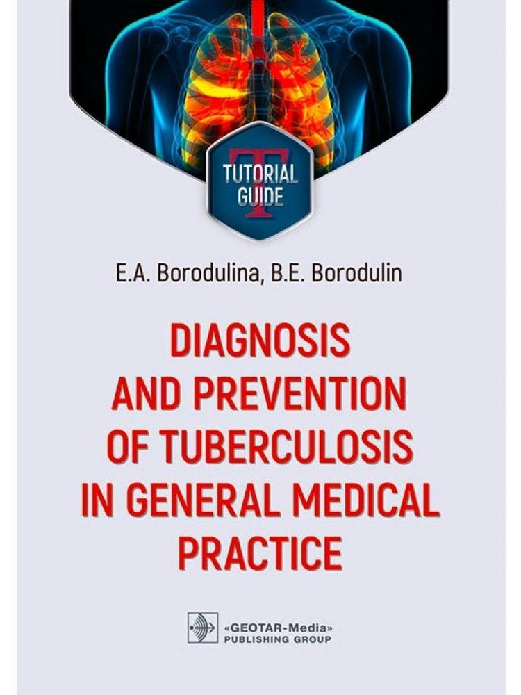 Diagnosis and prevention of tuberculosis in general medical #1