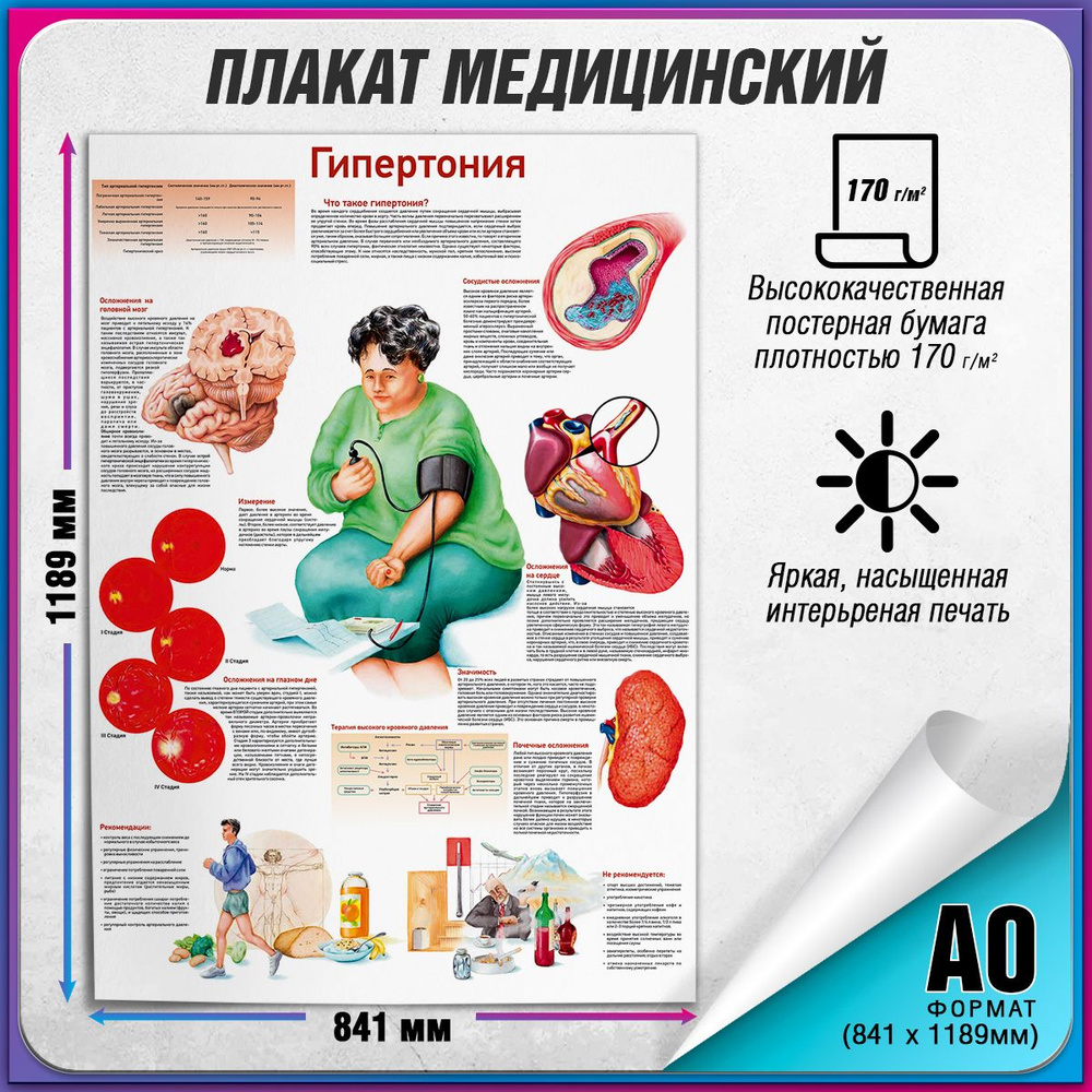 Информационный медицинский плакат "Гипертония" / А-0 (84x119 см.)  #1