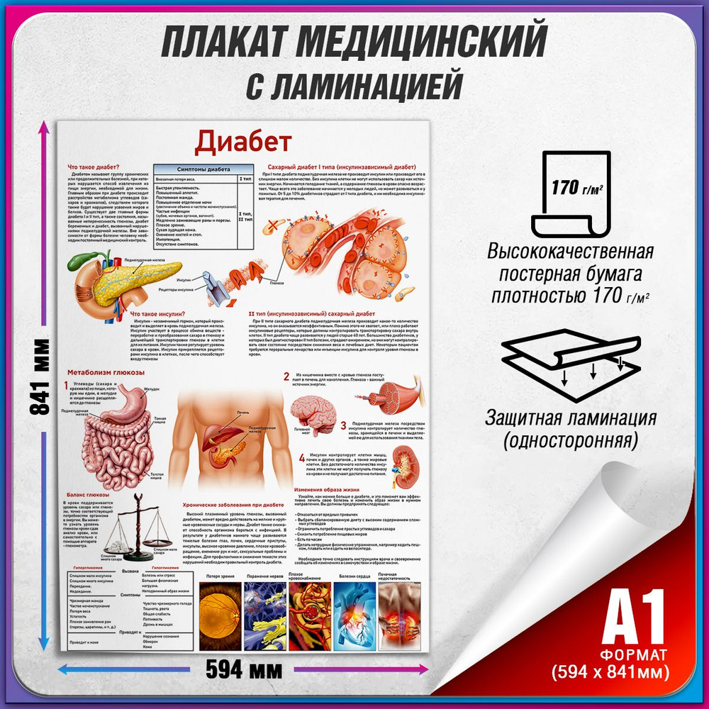 Информационный медицинский плакат "Диабет" / ламинированный / А-1 (84x60 см.)  #1