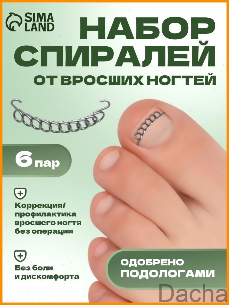 Наборспиралейдлякоррекциивросшихногтей,12шт,цветсеребристый