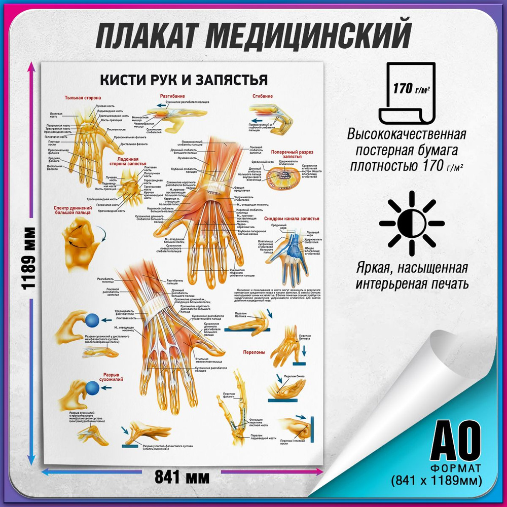 Информационный медицинский плакат "Кисти рук и запястья" / А-0 (84x119 см.)  #1