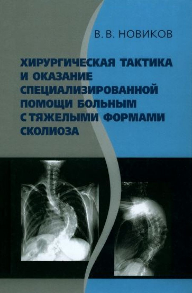 Хирургическая тактика и оказание специализированной помощи больным с тяжёлыми формами сколиоза  #1