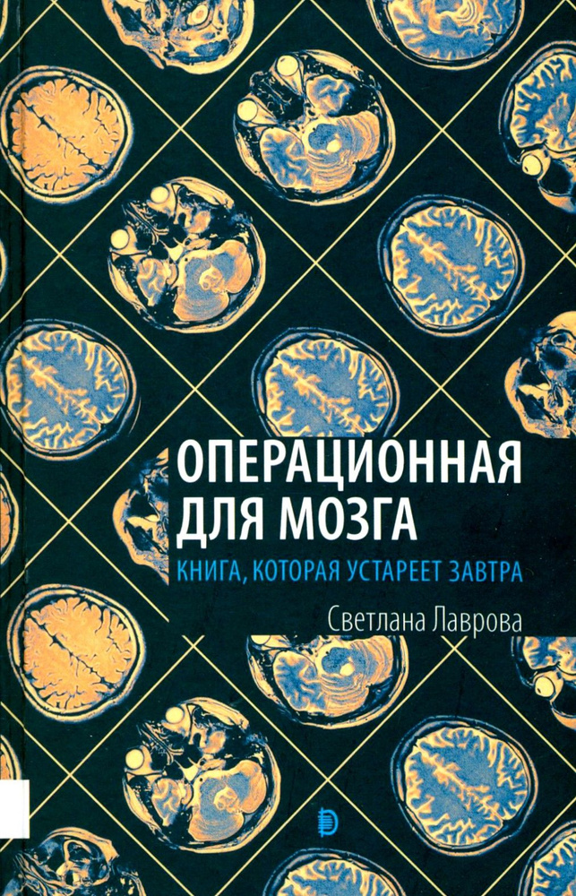 Операционная для мозга. Книга, которая устареет завтра | Лаврова Светлана Аркадьевна  #1