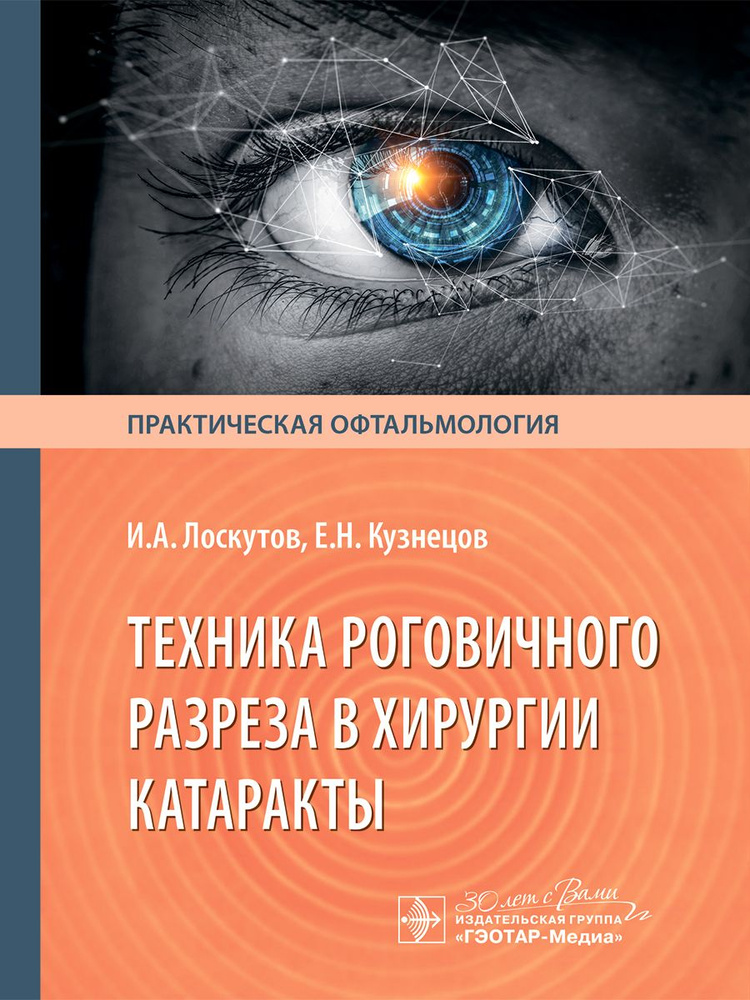 Техника роговичного разреза в хирургии катаракты #1