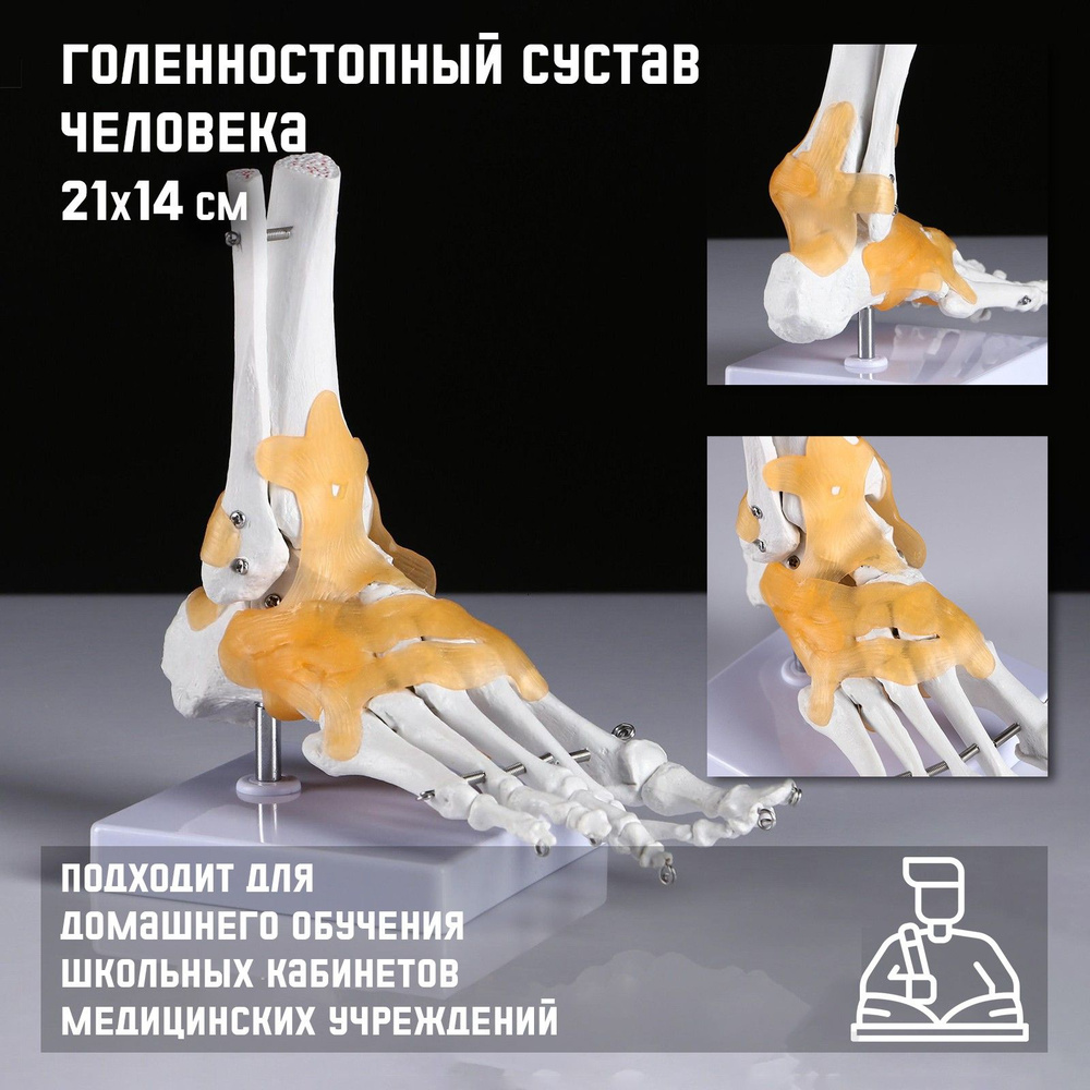 Макет "Голенностопный сустав человека" 21*20см #1