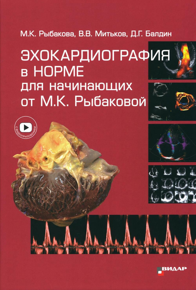 Эхокардиография в норме для начинающих от М.К. Рыбаковой | Рыбакова Марина Константиновна, Митьков Владимир #1