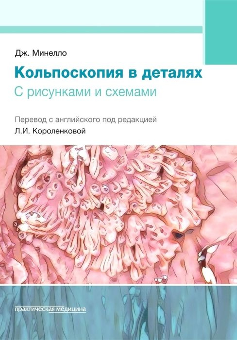 Кольпоскопия в деталях с рисунками и схемами. Минелло. 2024г.  #1