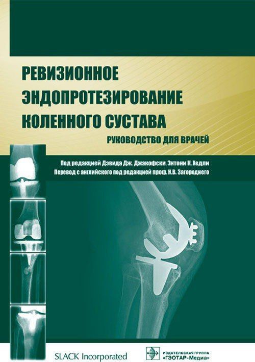 Ревизионное эндопротезирование коленного сустава.Руководство для врачей.Энтони К. Хедли. 2015 г., 320 #1