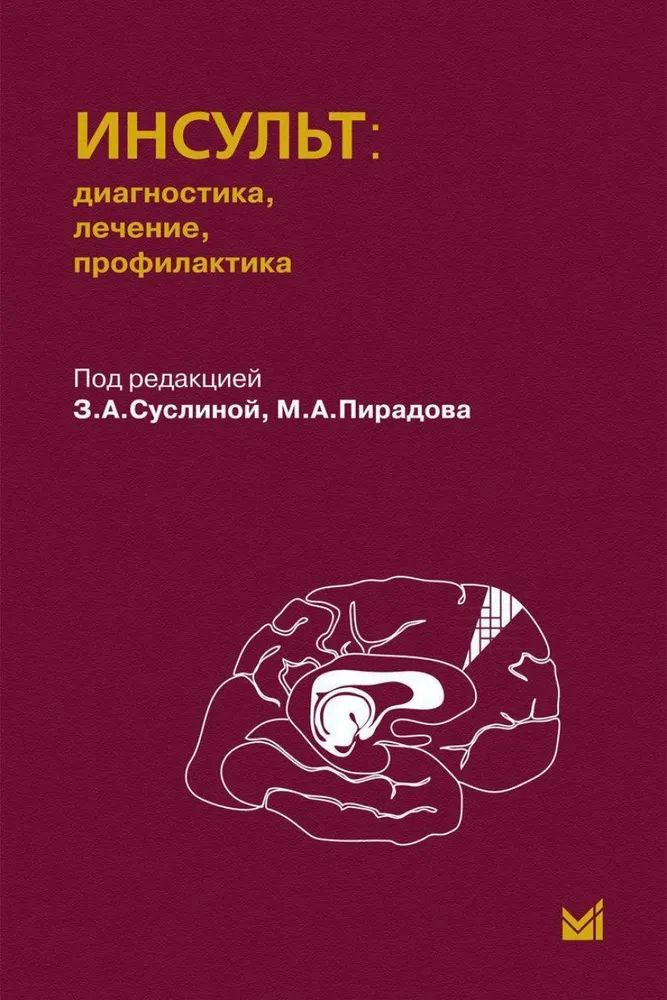 Инсульт. Диагностика, лечение, профилактика #1