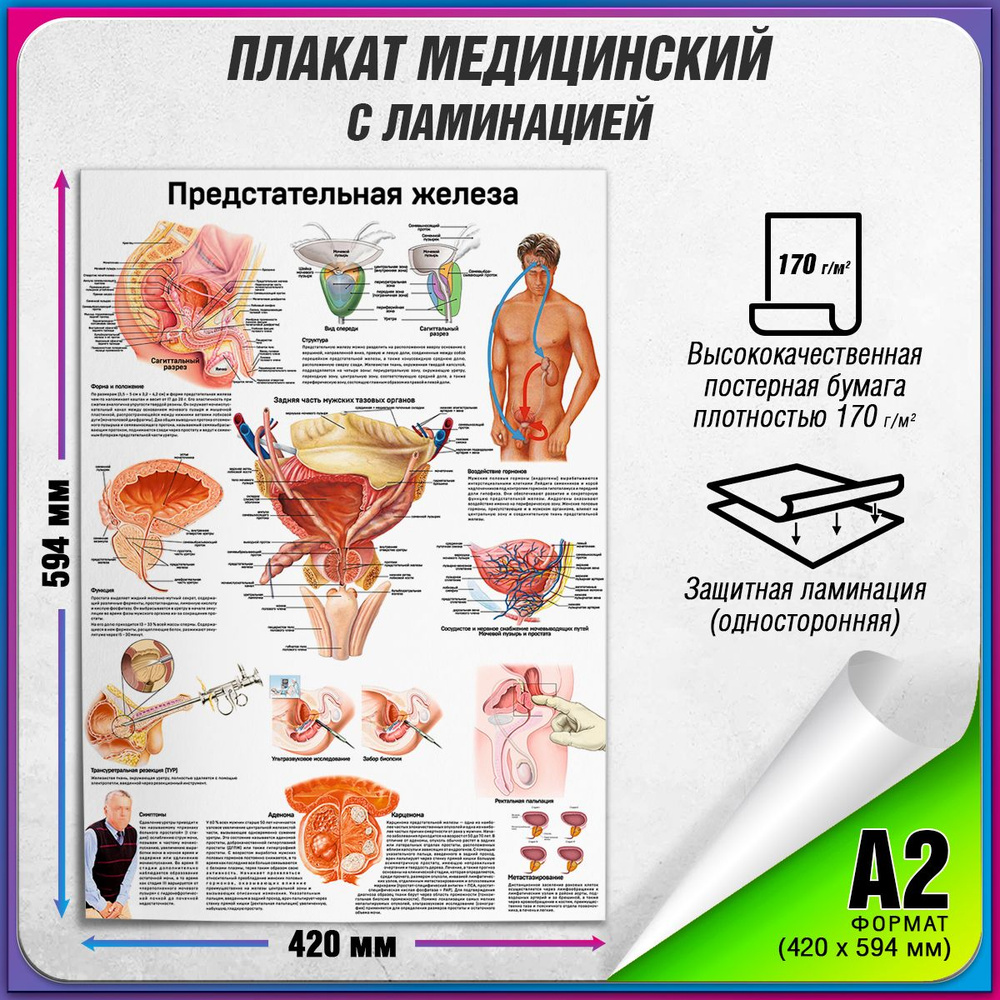 Информационный медицинский плакат "Предстательная железа" / ламинированный / А-2 (42x60 см.)  #1