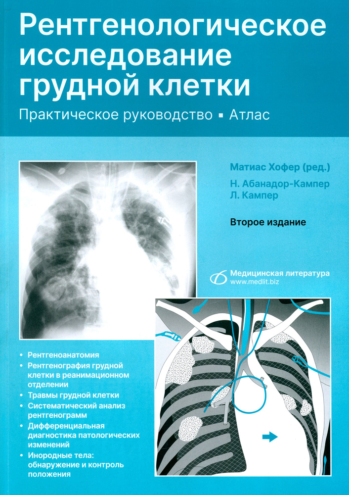 Рентгенологическое исследование грудной клетки. Практическое руководство. Атлас | Хофер Матиас  #1