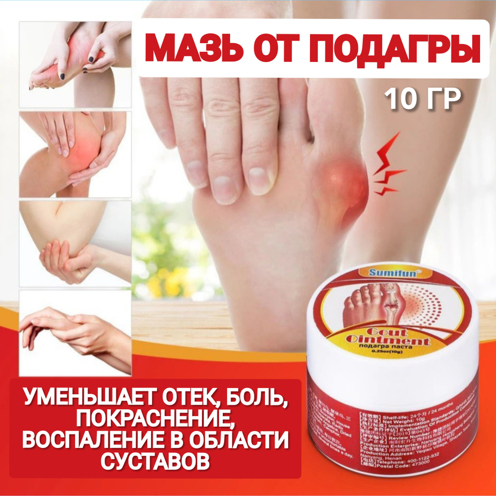 Крем от подагры, обезболивающий бальзам для снятия боли в пальцах и суставах, средство для ухода за ногами, #1