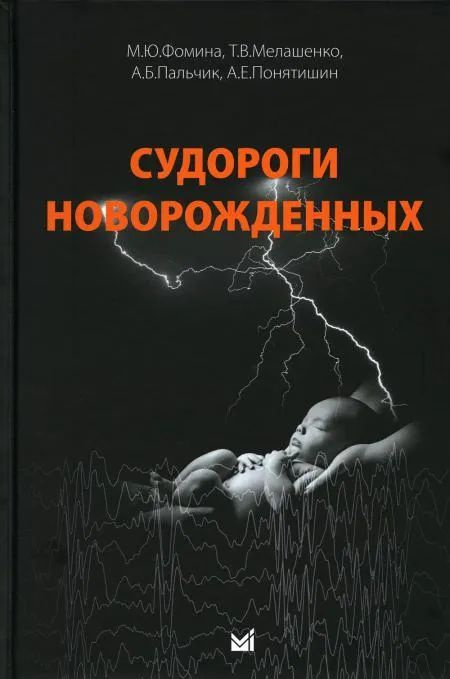 Судороги новорожденных. Пальчик А.Б., Мелашенко Т.В., Фомина М.Ю  #1