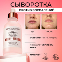 Revolution Skincare Сыворотка для лица с ниацинамидом, цинком, от прыщей 10% Niacinamide + 1% Zinc для проблемной кожи, 30 мл