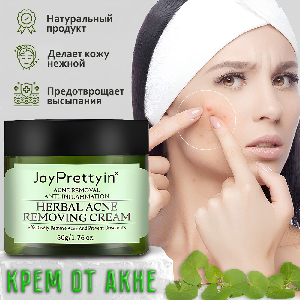 JoyPretty, Крем для лица для лечения акне, 50 г #1