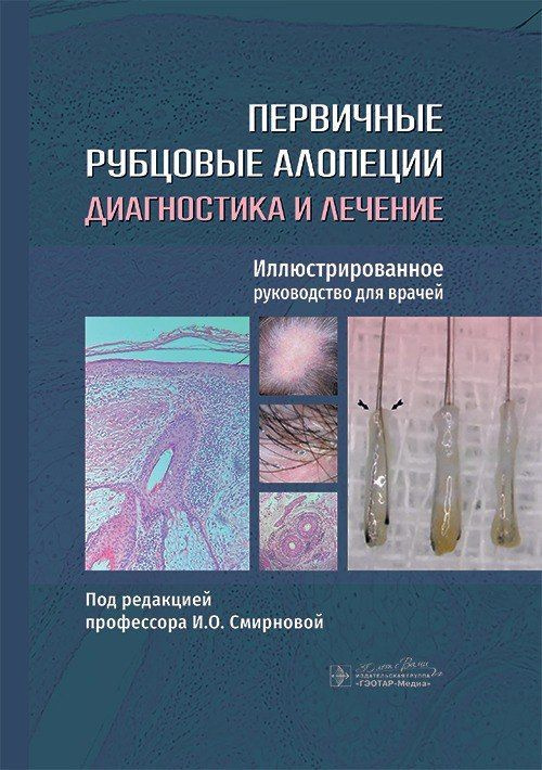 Первичные рубцовые алопеции: диагностика и лечение : иллюстрированное руководство для врачей / под ред. #1