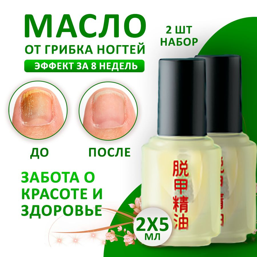 Масло для ногтей, средство от грибка и онихолизиса, SilaVeRes, 2 шт. по 5 мл  #1
