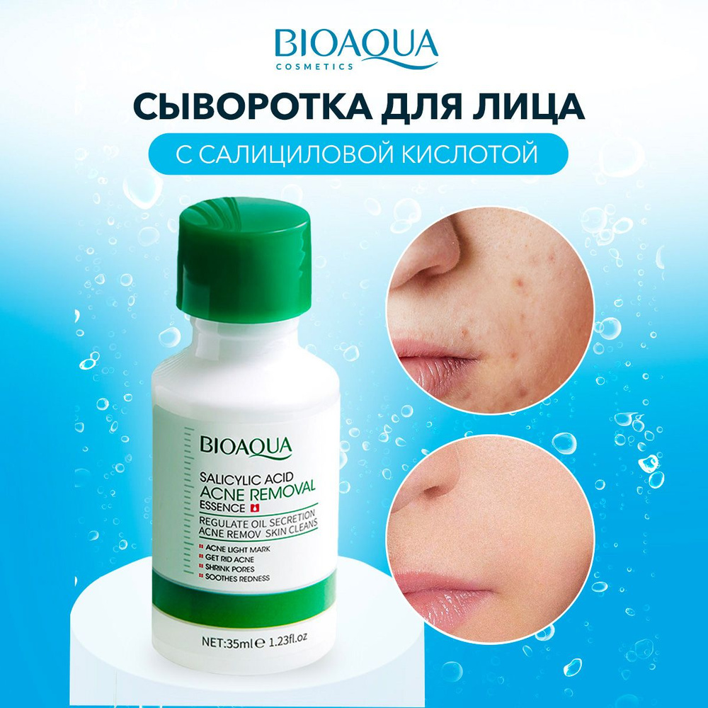 Сыворотка для лица от прыщей увлажняющая с салициловой кислотой / Bioaqua  #1