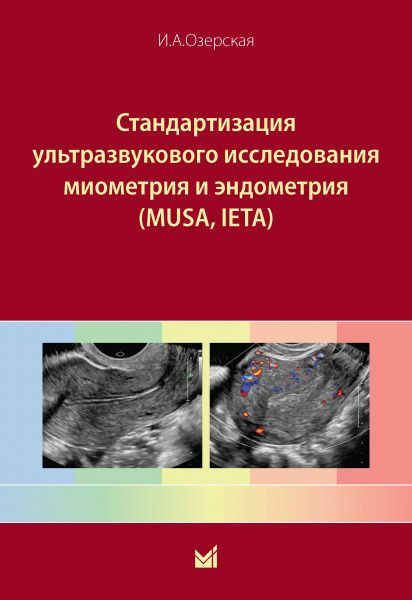 Стандартизация ультразвукового исследования миометрия и эндометрия (MUSA, IETA)  #1