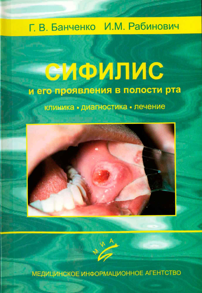 Сифилис и его проявление в полости рта - купить с доставкой по выгодным ...