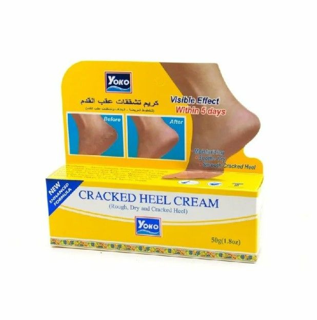 Крем от трещин на пятках и локтях Yoko Cracked Heel Cream, 50 гр #1