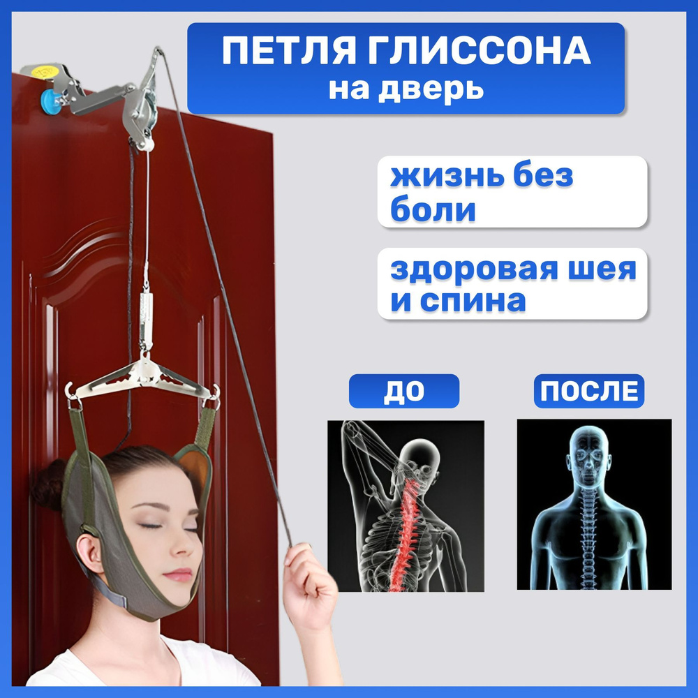 Петля в шее. Петля Глиссона. Карта Глиссона высокое разрешение