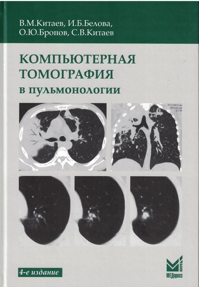 Компьютерная томография в пульмонологии #1