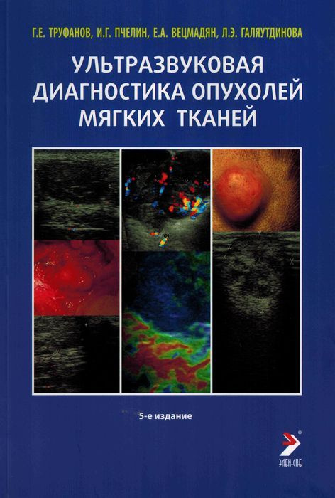 Ультразвуковая диагностика опухолей мягких тканей. Труфанов Г.Е., Пчелин И.Г., Вецмадян Е.А.  #1