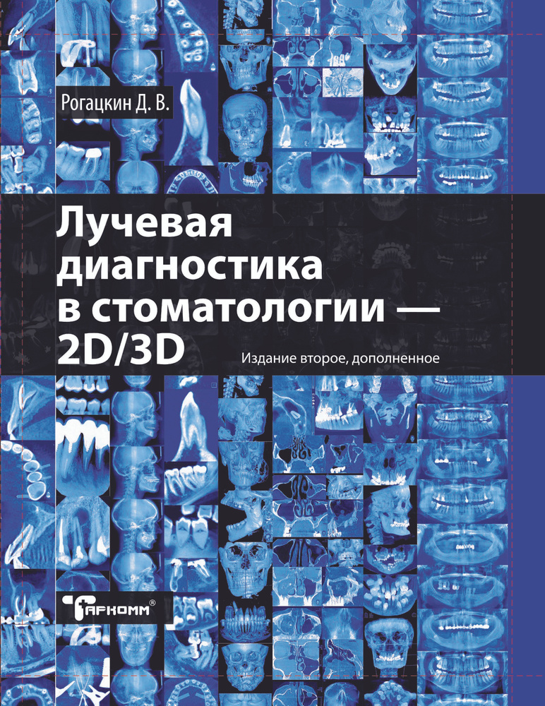 Лучевая диагностика в стоматологии: 2D/3D 2-е издание | Рогацкин Дмитрий Васильевич  #1